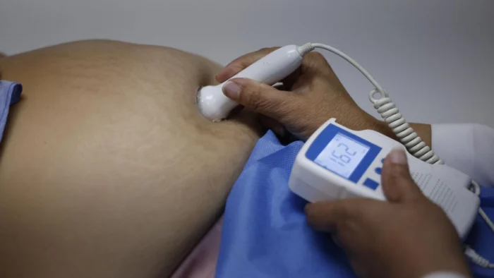 El Supremo condena a ginecólogas por usar fórceps sin informar a la paciente