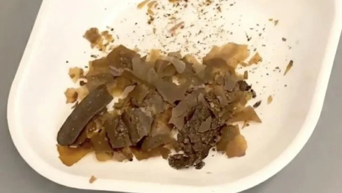 ¿Por qué los romanos elaboraban medicamentos con excrementos humanos?