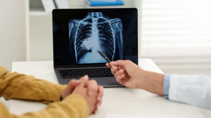 Detectados casos de tuberculosis latente en el Instituto de Medicina Legal de Toledo